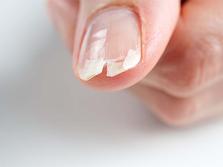 How to Fix a Vertical Split Nail and Prevent It from Coming Back - Mersi Cosmetics