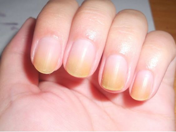 How To Get Rid Of Nail Stains - Mersi Cosmetics